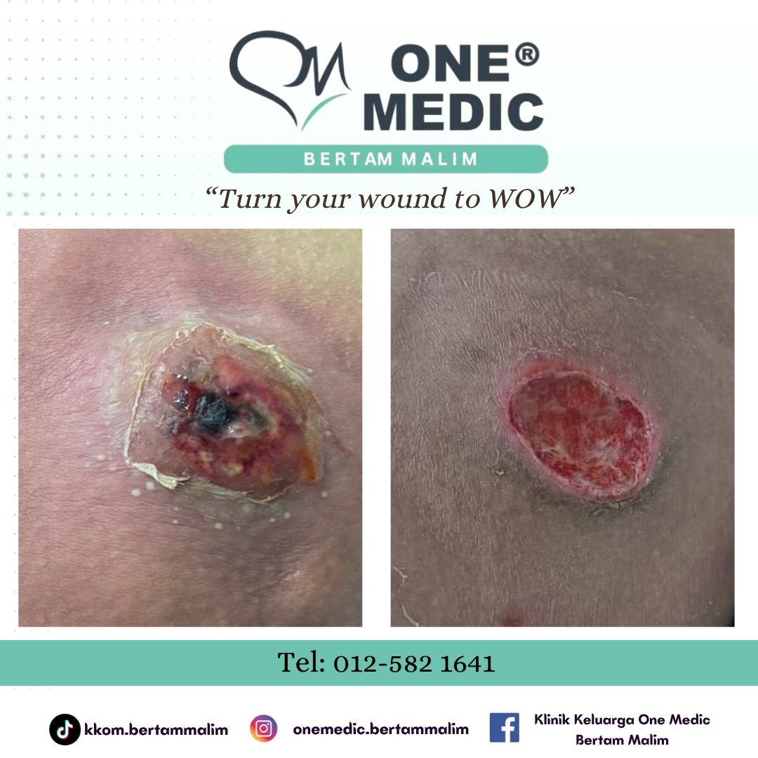b4 after one medic results (2)